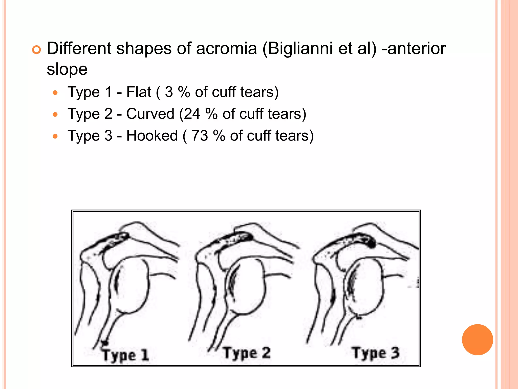  Different shapes of acromia (Biglianni et al) -anterior
slope
 Type 1 - Flat ( 3 % of cuff tears)
 Type 2 - Curved (24 % of cuff tears)
 Type 3 - Hooked ( 73 % of cuff tears)
 