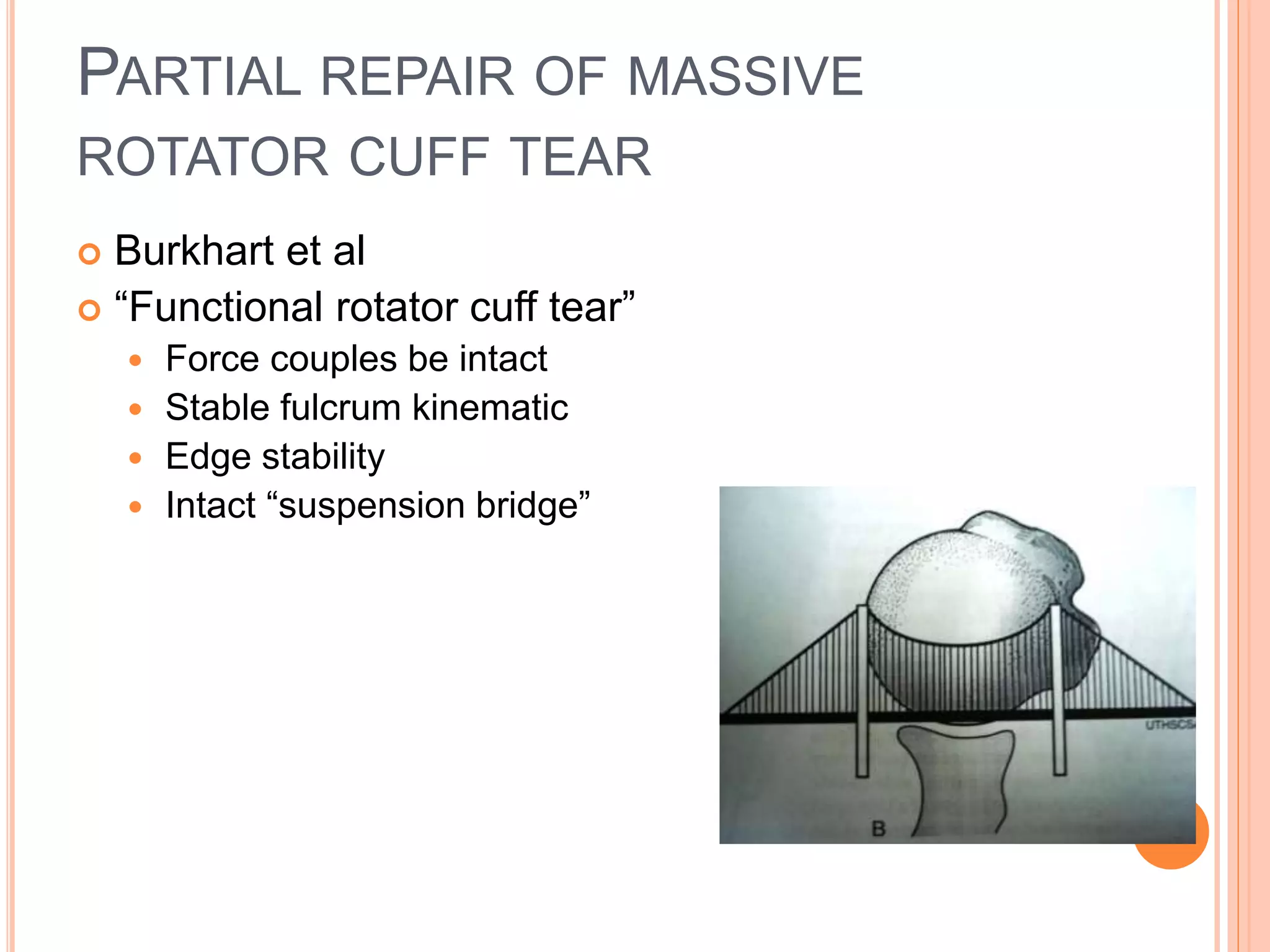 PARTIAL REPAIR OF MASSIVE
ROTATOR CUFF TEAR
 Burkhart et al
 “Functional rotator cuff tear”
 Force couples be intact
 Stable fulcrum kinematic
 Edge stability
 Intact “suspension bridge”
 
