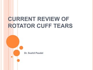 CURRENT REVIEW OF
ROTATOR CUFF TEARS
Dr. Sushil Paudel
 
