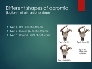 Rotator cuff tears ortho presentation.pptx