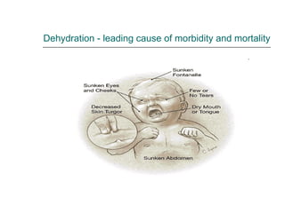 Dehydration - leading cause of morbidity and mortality 