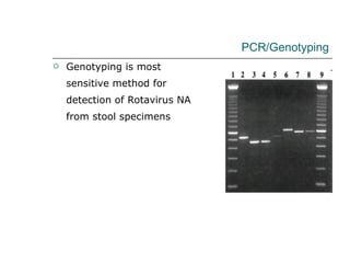 PCR/Genotyping Genotyping is most sensitive method for detection of Rotavirus NA from stool specimens 