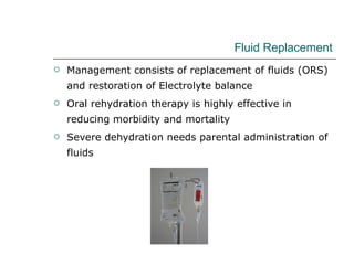 Fluid Replacement  Management consists of replacement of fluids (ORS) and restoration of Electrolyte balance Oral rehydration therapy is highly effective in reducing morbidity and mortality Severe dehydration needs parental administration of fluids 