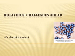 ROTAVIRUS- CHALLENGES AHEAD
- Dr. Gulrukh Hashmi
 
