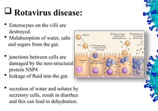 34
 Rotavirus disease:
 Enterocytes on the villi are
destroyed.
 Malabsorption of water, salts
and sugars from the gut.
 junctions between cells are
damaged by the non-structural
protein NSP4
 leakage of ﬂuid into the gut.
 secretion of water and solutes by
secretory cells, result in diarrhea
and this can lead to dehydration.
 
