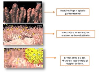 Rotavirus llega al epitelio
gastrointestinal
Infectando a los enterocitos
maduros en las vellosidades
El virus entra a la cel.
Entre el ligado viral y el
receptor de la cel.
 