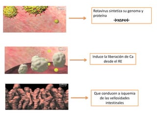 Rotavirus sintetiza su genoma y
proteína
NSP4
Induce la liberación de Ca
desde el RE
Que conducen a isquemia
de las vellosidades
intestinales
 