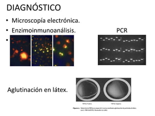 DIAGNÓSTICO
• Microscopía electrónica.
• Enzimoinmunoanálisis. PCR
•
Aglutinación en látex.
 
