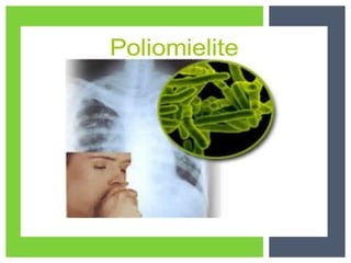 Rotavírus e poliomielite