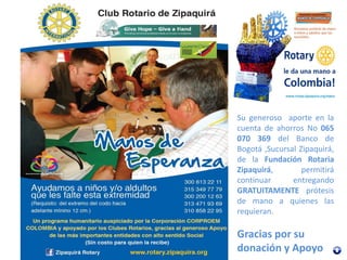 Su generoso aporte en la
cuenta de ahorros No 065
070 369 del Banco de
Bogotá ,Sucursal Zipaquirá,
de la Fundación Rotaria
Zipaquirá, permitirá
continuar entregando
GRATUITAMENTE prótesis
de mano a quienes las
requieran.
Gracias por su
donación y Apoyo
 