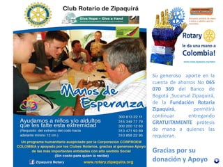 Su generoso aporte en la
cuenta de ahorros No 065
070 369 del Banco de
Bogotá ,Sucursal Zipaquirá,
de la Fundación Rotaria
Zipaquirá, permitirá
continuar entregando
GRATUITAMENTE prótesis
de mano a quienes las
requieran.
Gracias por su
donación y Apoyo
 