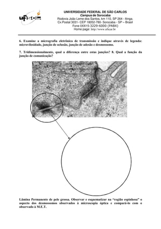 UNIVERSIDADE FEDERAL DE SÃO CARLOS
Campus de Sorocaba
Rodovia João Leme dos Santos, km 110, SP 264 - Itinga.
Cx.Postal 3031- CEP 18052-780- Sorocaba - SP – Brasil
Fone 0XX15-3229-6000 (PABX)
Home page: http://www.ufscar.br
6. Examine a micrografia eletrônica de transmissão e indique através de legenda:
microvilosidade, junção de oclusão, junção de adesão e desmossomo.
7. Tridimensionalmente, qual a diferença entre estas junções? 8. Qual a função da
junção de comunicação?
Lâmina Permanente de pele grossa. Observar e esquematizar na “região espinhosa” o
aspecto dos desmossomos observados à microscopia óptica e compará-lo com o
observado à M.E.T.
 