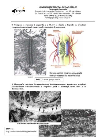 UNIVERSIDADE FEDERAL DE SÃO CARLOS
Campus de Sorocaba
Rodovia João Leme dos Santos, km 110, SP 264 - Itinga.
Cx.Postal 3031- CEP 18052-780- Sorocaba - SP – Brasil
Fone 0XX15-3229-6000 (PABX)
Home page: http://www.ufscar.br
8. Compare o esquema à esquerda e a M.E.T. à direita e legende os principais
componentes estruturais e macromoleculares dos desmossomos.
9. Micrografia eletrônica de transmissão de hemidesmossomos. Aponte suas principais
características ultra-estruturais e responda qual a diferença entre estes e os
desmossomos.
FONTE: www.google.com.br
FONTE:
http://setimocientista.blogspot.com.br/
 