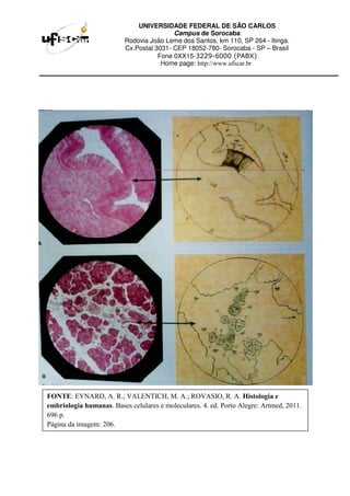 UNIVERSIDADE FEDERAL DE SÃO CARLOS
Campus de Sorocaba
Rodovia João Leme dos Santos, km 110, SP 264 - Itinga.
Cx.Postal 3031- CEP 18052-780- Sorocaba - SP – Brasil
Fone 0XX15-3229-6000 (PABX)
Home page: http://www.ufscar.br
FONTE: EYNARD, A. R.; VALENTICH, M. A.; ROVASIO, R. A. Histologia e
embriologia humanas. Bases celulares e moleculares. 4. ed. Porto Alegre: Artmed, 2011.
696 p.
Página da imagem: 206.
 