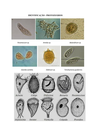 IDENTIFICAÇÃO - PROTOZOÁRIOS
Paramecium sp. Ameba sp. Balanditium sp.
Giardia Lamblia Didinium sp. Tetrahymena pyriformis
 