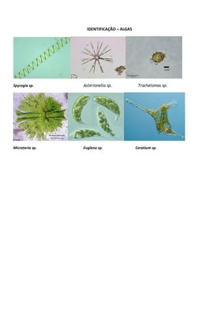 IDENTIFICAÇÃO – ALGAS
Spyrogia sp. Asterionella sp. Trachelomas sp.
Micrateria sp. Euglena sp. Ceratium sp.
 