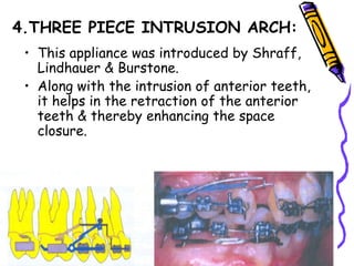 4.THREE PIECE INTRUSION ARCH:
• This appliance was introduced by Shraff,
Lindhauer & Burstone.
• Along with the intrusion of anterior teeth,
it helps in the retraction of the anterior
teeth & thereby enhancing the space
closure.
 