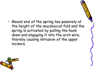 • Mesial end of the spring lies passively at
the height of the mucobuccal fold and the
spring is activated by pulling the hook
down and engaging it into the arch wire,
thereby causing intrusion of the upper
incisors.
 