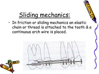 Sliding mechanics:
• In friction or sliding mechanics an elastic
chain or thread is attached to the tooth & a
continuous arch wire is placed.
 
