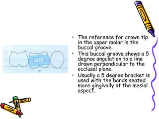 • The reference for crown tip
in the upper molar is the
buccal groove.
• This buccal groove shows a 5
degree angulation to a line
drawn perpendicular to the
occlusal plane.
• Usually a 5 degree bracket is
used with the bands seated
more gingivally at the mesial
aspect.
 