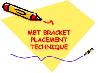 MBT BRACKET
PLACEMENT
TECHNIQUE
 