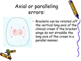 Axial or paralleling
errors:
• Brackets can be rotated off
the vertical long axis of the
clinical crown if the bracket
wings do not straddle the
long axis of the crown in a
parallel manner.
 