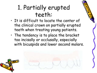 1. Partially erupted
teeth:
• It is difficult to locate the center of
the clinical crown on partially erupted
teeth when treating young patients.
• The tendency is to place the bracket
too incisally or occlusally, especially
with bicuspids and lower second molars.
 
