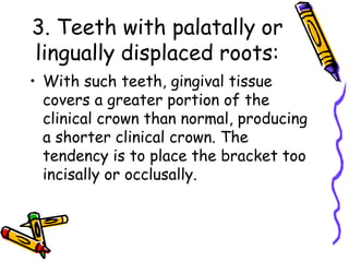 3. Teeth with palatally or
lingually displaced roots:
• With such teeth, gingival tissue
covers a greater portion of the
clinical crown than normal, producing
a shorter clinical crown. The
tendency is to place the bracket too
incisally or occlusally.
 