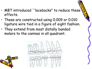 • MBT introduced ''lacebacks" to reduce these
effects.
• These are constructed using 0.009 or 0.010
ligature wire tied in a figure of eight fashion.
• They extend from most distally banded
molars to the canines in all quadrant.
 