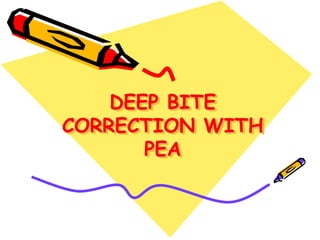 DEEP BITE
CORRECTION WITH
PEA
 