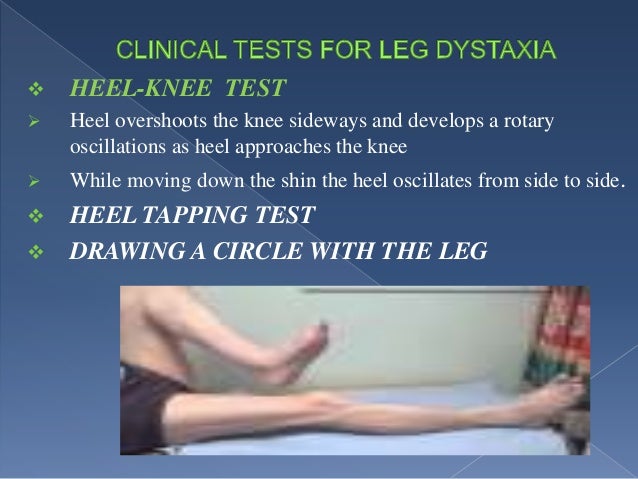 Cerebellum Gait By Dr Roto Robo