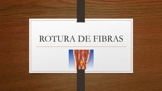 ROTURA DE FIBRAS
 