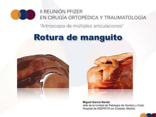 Rotura de manguito




         Miguel García Navlet
         Jefe de la Unidad de Patología de Hombro y Codo
         Hospital de ASEPEYO en Coslada, Madrid.
 