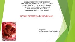 ROTURA PREMATURA DE MEMBRANAS
REPÚBLICA BOLIVARIANA DE VENEZUELA
MINISTERIO DEL PODER POPULAR PARA LA SALUD
UNIVERSIDAD DE LAS CIENCIAS DE LA SALUD
HOSPITAL GENERAL GUATIRE GUARENAS
“DR. EUGENIO P. D´BELLARD”
PNFA DE GINECOLOGÍA Y OBSTETRICIA
Integrantes:
Dr. Rayko Machín Cortina (R – 1)
 