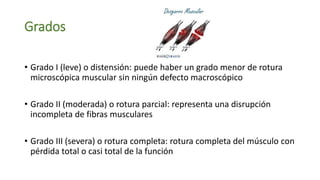 Grados
• Grado I (leve) o distensión: puede haber un grado menor de rotura
microscópica muscular sin ningún defecto macroscópico
• Grado II (moderada) o rotura parcial: representa una disrupción
incompleta de fibras musculares
• Grado III (severa) o rotura completa: rotura completa del músculo con
pérdida total o casi total de la función
 