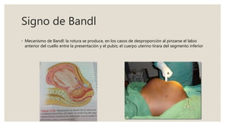 Signo de Bandl
◦ Mecanismo de Bandl: la rotura se produce, en los casos de desproporción al pinzarse el labio
anterior del cuello entre la presentación y el pubis; el cuerpo uterino tirara del segmento inferior
 
