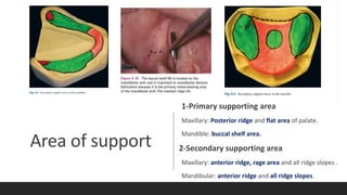 Area of support
1-Primary supporting area
Maxillary: Posterior ridge and flat area of palate.
Mandible: buccal shelf area.
2-Secondary supporting area
Maxillary: anterior ridge, rage area and all ridge slopes .
Mandibular: anterior ridge and all ridge slopes.
 