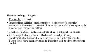 Histopathology – 3 types
• Trabecular or classic
• Intermediate cellular - most common - existence of a circular
arrangement in nests or rosettes of intermediate cells, accompanied by
a peripheral trabecular pattern
• Small-cell pattern - diffuse infiltrate of neoplastic cells in sheets
• Surface epithelium is intact. Moderately sized, uniform,
undifferentiated basophillic cells in dermis and subcutaneous fat.
Tumor cells have scant cytoplasm, indistinct cell borders, prominent
nuclei.
Dr.Aldrin Jerry
 