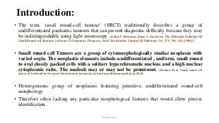 Introduction:
• The term ‘small round-cell tumour’ (SRCT) traditionally describes a group of
undifferentiated paediatric tumours that can present diagnostic difficulty because they may
be indistinguishable using light microscopy. [Aidan P. Mcmanus, Barry A. Gusterson. The Molecular Pathology Of
Small Round-cell Tumours-relevance To Diagnosis, Prognosis, And Classification. Journal Of Pathology, Vol. 178: 116--121 (1996)])
• Small round cell Tumors are a group of cytomorphologically similar neoplasm with
varied orgin. The neoplastic elements include undifferentiated , uniform, small round
to oval closely packed cells with a solitary hyperchromatic nucleus and a high nuclear
cytoplasmic ratio. The nucleoli may or may not be prominent. (Reshma Et al. Small round cell
tumor of head and neck region.International journal of oral and maxillofacial pathology.2014)
• Heterogeneous group of neoplasms featuring primitive, undifferentiated round-cell
morphology
• Therefore often lacking any particular morphological features that would allow precise
identification.
Dr.Aldrin Jerry
 