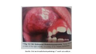 Neville. Oral and maxillofacial pathology 1st south asia editionDr.Aldrin Jerry
 