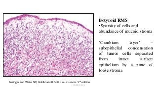 Botyroid RMS
•Sparsity of cells and
abundance of mucoid stroma
‘Cambium layer’ –
subepithelial condensation
of tumor cells separated
from intact surface
epithelium by a zone of
loose stroma
Enzinger and Weiss SW, Goldblum JR. Soft tissue tumors. 5th edition
Dr.Aldrin Jerry
 
