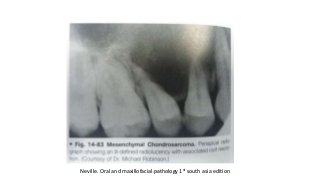 Neville. Oral and maxillofacial pathology 1st south asia editionDr.Aldrin Jerry
 