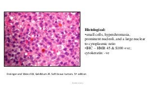 Histological:
•small cells, hyperchromasia,
prominent nucleoli, and a large nuclear
to cytoplasmic ratio
•IHC – HMB 45 & S100 +ve;
cytokeratin: -ve
Enzinger and Weiss SW, Goldblum JR. Soft tissue tumors. 5th edition
Dr.Aldrin Jerry
 