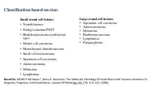 Classification based on size:
Small round cell lesions:
• Neuroblastoma
• Ewing’s sarcoma/PNET
• Rhabdomyosarcoma (embryonal
type)
• Merkel cell carcinoma
• Mesenchymal chondrosarcoma
• Small cell osteosarcoma
• Squamous cell carcinoma
• Adenocarcinoma
• Melanoma
• Lymphomas
Large round cell lesions:
• Squamous cell carcinoma
• Adenocarcinoma
• Melanoma
• Rhabdomyosarcoma
• Lymphomas
• Paraganglioma
Based On: AIDAN P. Mcmanus*, Barry A. Gusterson. The Molecular Pathology Of Small Round-cell Tumours-relevance To
Diagnosis, Prognosis, And Classification. Journal Of Pathology, Vol. 178: 116--121 (1996)Dr.Aldrin Jerry
 