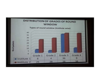 Round Window Digram Round window | PPTX