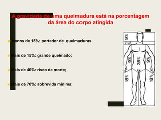 A gravidade de uma queimadura está na porcentagem
da área do corpo atingida
Menos de 15%: portador de queimaduras
Mais de 15%: grande queimado;
Mais de 40%: risco de morte;
Mais de 70%: sobrevida mínima;
 
