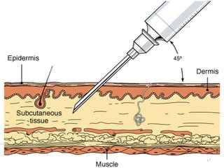 Routes of parenteral administration | PPTX