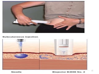 Septical Injection Routes of parenteral administration | PPTX