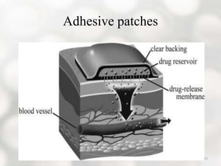 Routes of parenteral administration | PPTX