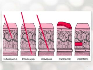 Routes of parenteral administration | PPTX